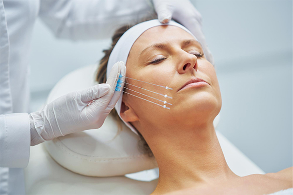 Thread Lift Treatment in Gurgaon