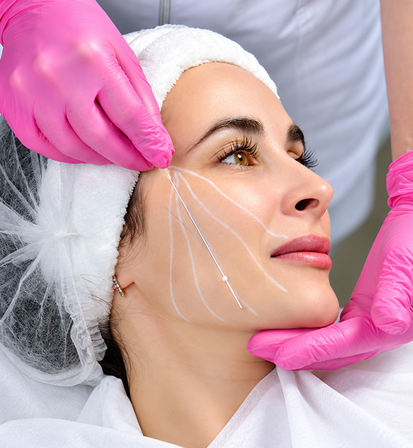 Thread Lift treatment and consultation