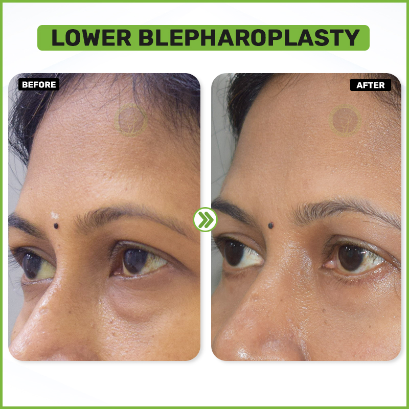 Before and After 2