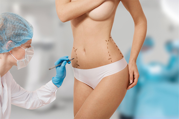 Tummy Tuck Surgery in Gurgaon