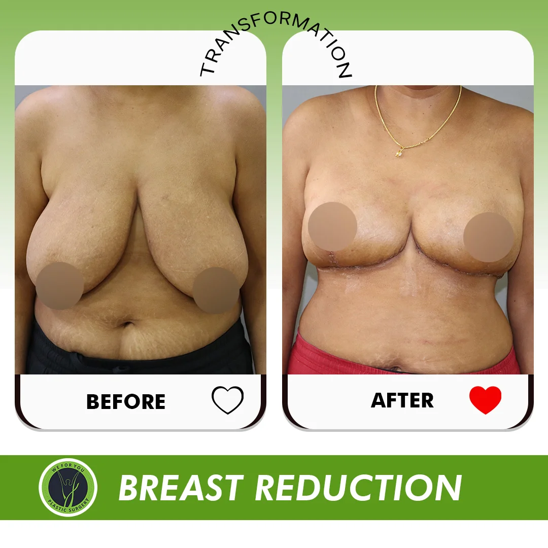 Before and After 11