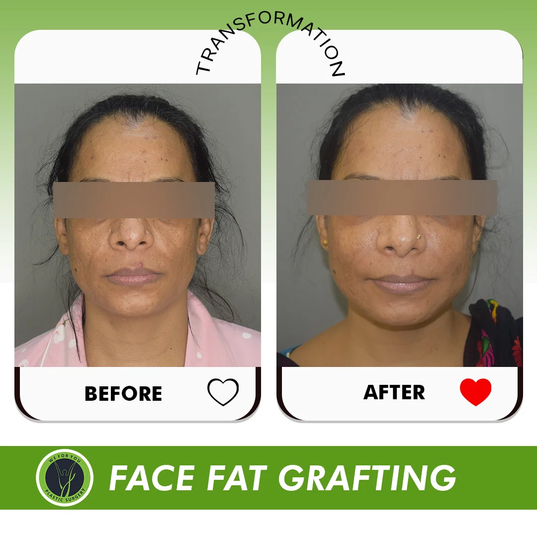 Before and After 1