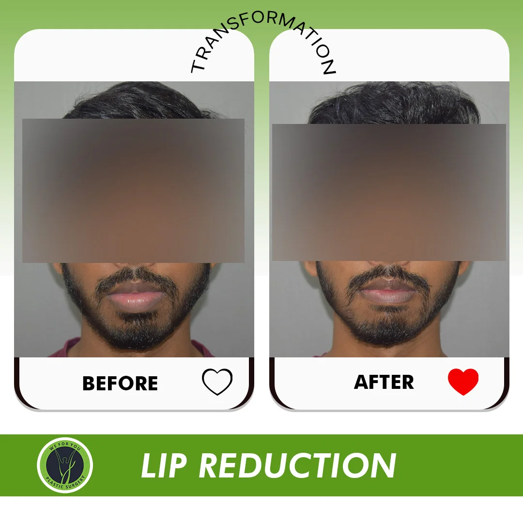 Before and After 7