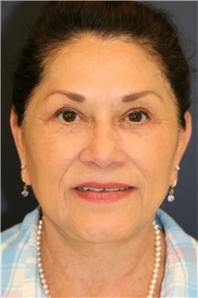After treatment